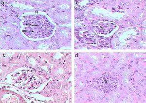 Glomerular analysis of kidney from control (a), Gm (b, c) and GmP (d) group of mice.