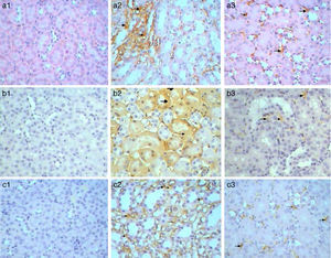 Immunohistochemical staining of, caspase 3 in control (a1), Gm (a2) and GmP (a3), Kim-1 control (b1), Gm (b2) and GmP (b3) and Malondialdehyde in control (c1), Gm (c2) and GmP (c3) group of mice.