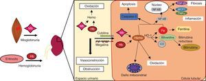Mecanismos de daño renal por hemoproteínas.