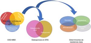 Relación entre Chronic Kidney Disease - Mineral and Bone Disorder (CKD-MBD), osteodistrofia renal (alteración ósea secundaria a la presencia de enfermedad renal crónica [ERC]) y OP (relacionada con la uremia o la edad y sexo de los pacientes, entre otros factores). La resistencia ósea viene determinada no solo por la densidad mineral ósea sino también por la calidad del hueso, expresado por sus determinantes94,151. Aunque algunos autores utilizan el término OP «urémica»17, no debemos olvidar a la ERC no terminal, pudiendo integrarse dentro del complejo CKD-MBD al poder condicionar su empeoramiento. Adaptada de Moe151 y West et al.94.