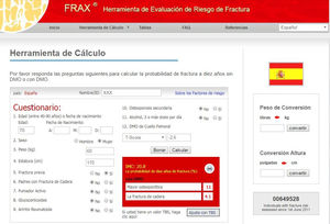 Ejemplo de cálculo por Fracture Risk Assessment Tool (FRAX®): para España (http://www.shef.ac.uk/FRAX®/tool.aspx?country=4). El algoritmo de FRAX® calcula la probabilidad de fractura mayor osteoporótica de modo país específico. Además de los factores obvios mostrados, se incluyen en la valoración la administración previa o actual de corticosteroides durante más de 3 meses (5mg o más de prednisolona o equivalente), OP concomitante con artritis reumatoide, OP secundaria a trastornos estrechamente ligados a ella (diabetes tipo 1, osteogénesis imperfecta en adultos, hipertiroidismo crónico no tratado, hipogonadismo o menopausia prematura, malnutrición crónica, malabsorción y enfermedad crónica del hígado), ingestión de más de tres unidades de alcohol al día y finalmente, de modo opcional, la DMO del cuello del fémur. Al introducir los valores de DMO en el cálculo pueden también introducirse posteriormente valores de Trabecular Bone Score si se dispone de ellos. Entre las carencias de FRAX® destaca que incluye variables dicotómicas (sí/no) y que no se tienen en cuenta, por ejemplo, el número de fracturas previas, la dosis de corticoides, no diferencia fractura vertebral de otras fracturas, no valora caídas padecidas, es incompleta la valoración de OP secundarias (donde no se tiene en cuenta la enfermedad renal o el filtrado glomerular, entre otras causas) y hay dudas sobre la representatividad de la cohorte española46,47,115. FRAX® puede tener especial importancia en centros que no disponen de la posibilidad de medir la DMO mediante DEXA para plantear una potencial derivación de pacientes para su realización.