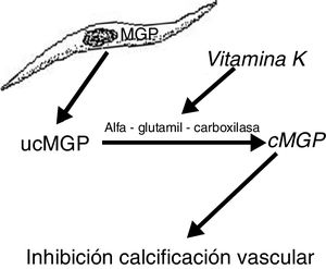 Esquema del efecto de la vitamina K sobre la matriz de proteína Gla. MGP: matriz de proteína Gla; cMGP: matriz de proteína Gla carboxilada; ucMGP: matriz de proteína Gla descarboxilada.