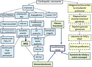 Fisiopatología de la nefropatía por cianosis. FF: fracción de filtración; FSR: flujo sanguíneo renal; GEFyS: glomerulosclerosis focal y segmentaria; GLM: glomérulo; GNCM: glomerulonefritis de cambios mínimos; HFG: hiperfiltración glomerular; HT: hipertrofia; PDGF: factor de crecimiento derivado de las plaquetas; TCP: túbulo contorneado proximal; TGFβ: factor de crecimiento tumoral β; VSD AA: vasodilatación arteriola aferente. Línea continua: vía de daño vascular; línea quebrada: vía de daño proliferativo; doble cuadrícula: vía de daño final.