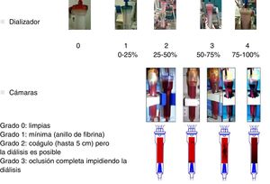 Scores de coagulación de cámaras y dializador.
