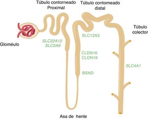 Esquema de la nefrona en el que se muestran los segmentos del túbulo donde se expresan los genes mencionados en el texto. Los genes SLC22A12 y SLC2A9 que codifican los transportadores de ácido úrico URAT1 y GLUT9 respectivamente, se expresan en el túbulo proximal renal. Los genes CLDN16 y CLDN19 que codifican las claudinas 16 y 19 respectivamente, se expresan en las zonas de unión estrechas de la rama gruesa ascendente del asa de Henle. El gen BSND que codifica la barttina se expresa en este último segmento tubular aunque, también, en las células de la stria vascularis del oído interno. El gen SLC12A3 que codifica el cotransportador de NaCl sensible a tiazidas se expresa en las células del túbulo contorneado distal. El gen SLC4A1 codifica las isoformas del intercambiador de aniones 1 (AE1) propias de eritrocitos y riñón. En ese último caso, la proteína se localiza en el ducto colector renal.