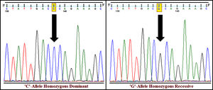 DNA sequence electropherograms of rs1801282 polymorphism in the PPARγ gene. Examples of homozygous dominant (JJ genotype) and homozygous recessive (jj genotype) condition of the studied SNP.