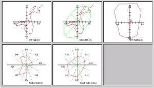 Ejemplo de los registros obtenidos de análisis vectorial, longitud, superficie y velocidad, de los desplazamientos del centro de presiones a lo largo del eje antero-posterior y medio-lateral.