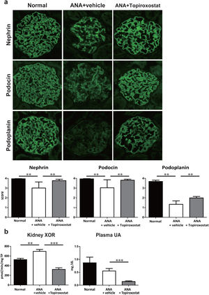 The effect of topiroxostat in anti-nephrin antibody (ANA)-induced podocyte injury. (a) Representative IF findings (upper panel), and the semi-quantitative data of immunostaining (lower panel) of podocyte functional molecules. Nephrin, podocin and podoplanin were observed as a continuous linear pattern along capillary loop in normal rat (Normal). The stainings shifted to a dot-like discontinuous pattern, and the intensity was reduced in the rats with ANA-induced podocyte injury (ANA+vehicle). Topiroxostat treatment restored the expression of all of these molecules, nephrin, podocin and podoplanin (ANA+Topiroxostat). (b) XOR activity and plasma UA level. XOR activity in kidney was increased. Topiroxostat treatment reduced the XOR activity in kidney and plasma UA. Data are shown as mean±SD. (**P<0.01, ***P<0.001).