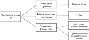 Tubular histological lesions according to immunofluorescence (IF) pattern in MGRS. LCDD (light chain deposition disease).