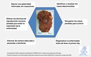 Nuestro modelo de Hexágono Preventivo de la PQRAD.