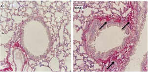 Representative photomicrographs of lung tissue stained with Picro-Sirius red at 400× magnification. C: control group; CKD: chronic kidney disease group.