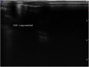 Thoracic USG of animals assessed. CKD: chronic kidney disease.