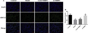 NRBP1 reduced the expression of ABCG2 protein level in HK-2 cells. A, Representative imaging from immunofluorescent staining (original magnification ×200). B, The relative fluorescent intensity for each group. (χ¯±s,n=3), *P<0.05, **P<0.01 vs. Control group, #P<0.05, ##P<0.01 vs. Model group.
