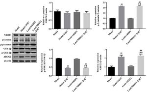 NRBP1 regulates uric acid transporter ABCG2 expression by activating the Wnt/β-catenin pathway in HK-2 cells. HK-2 cells were transfected with NRBP1 and cultured with 21H7 (Wnt/β-catenin-inhibitor), western blot was used to analyze the expression levels of NRBP1, β-catenin, p-β-catenin, GSK3β and p-GSK3β in HK-2 cells. (χ¯±s,n=3), #P<0.05, ##P<0.01 vs. Model group, ★P<0.05, ★★P<0.01 vs. Lenti-NRBP1 group.