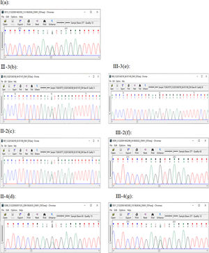 Electropherogram showing the mutation FAN1 c.1943+1G>A(p.?) found in family members (a, b, c, d: mutation found in patient I, II-2, II-3, II-4; e, f: wildtype).