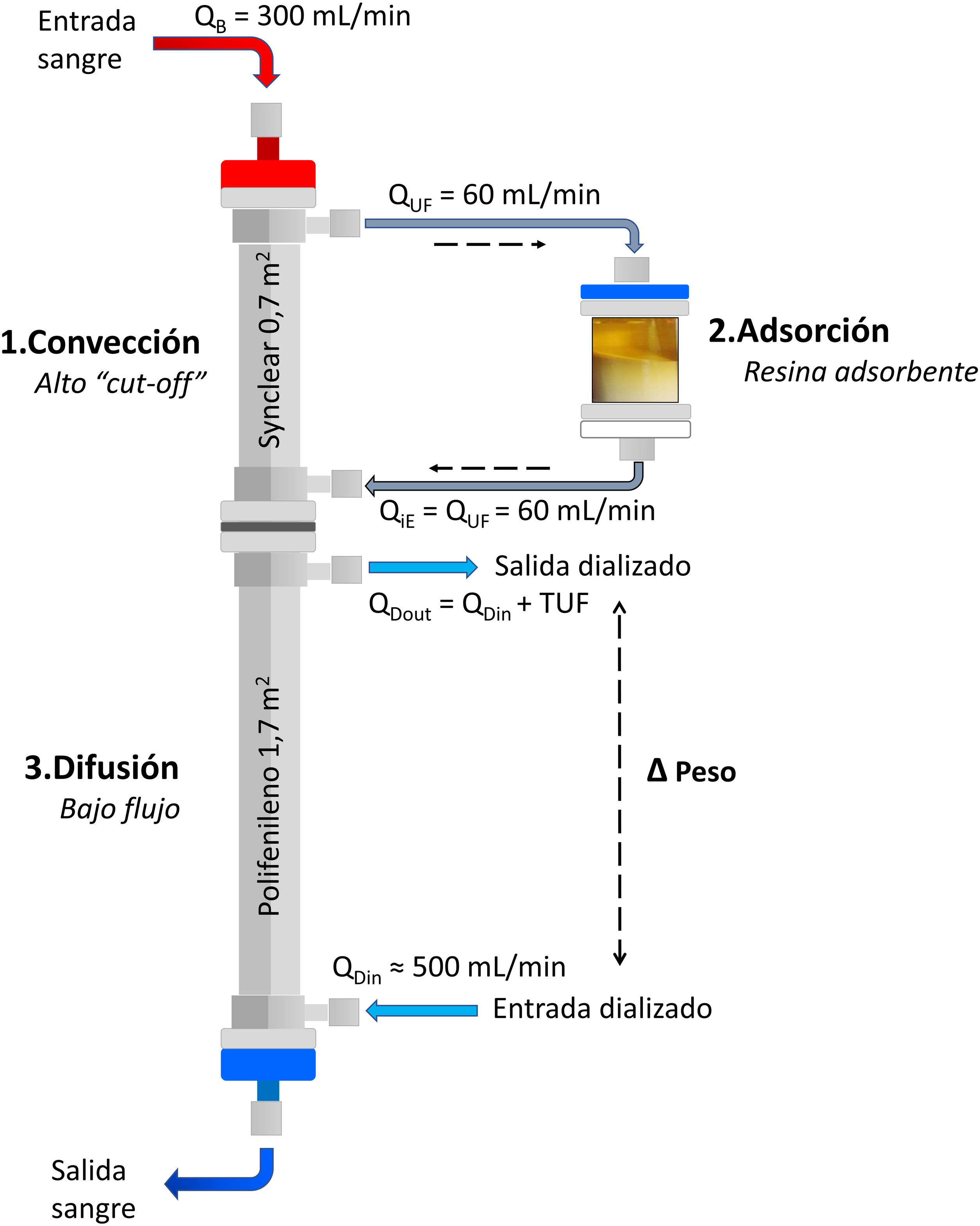 diagrama de plasmaféresis
