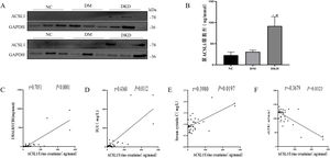 The expression of ACSL1 is increased in the urine of DKD patients, and there is a correlation with renal function in DKD patients. (A) WB analysis demonstrated that the expression level of ACSL1 was significantly increased in the urinary exfoliated cells of DKD patients. (B) ELISA showed that the expression level of ACSL1 was significantly increased in the urine supernatant of DKD patients. (C) Spearman correlation analysis was used to detect the correlation between urine supernatant ACSL1 and UACR. (D) Spearman correlation analysis was used to detect the correlation between urine supernatant ACSL1 and IGU. (E) Spearman correlation analysis was used to detect the correlation between urine supernatant ACSL1 and serum cystatin C. (F) Spearman correlation analysis was used to detect the correlation between urine supernatant ACSL1 and eGFR. *p<0.05, compared with NC; #p<0.05, compared with DM patients. The expression of ACSL1 in urine supernatants from NC (20 healthy person), DM (30 diabetes mellitus) and DKD (34 diabetic kidney disease) by ELISA.