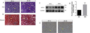 ACSL1 expression was increased in db/db mouse models. (A) Periodic acid-Schiff staining of the renal cortex sections of db/m and db/db mice. (B) Masson staining of the renal cortex sections of db/m and db/db mice. (C) WB results demonstrated the expression levels of total ACSL1 in mice. (D) Quantitation of the arbitrary ratios of ACSL1 to GAPDH. (E) The expression of ACSL1 in mice was assessed by immunohistochemistry. Data information: all values are shown as the means±SEMs of 6–8 rats. *P<0.05, mean db/db mice compared with db/m mice.