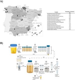 Obtención de las muestras y aislamiento de uEV. A) Mapa de España con la distribución geográfica de los centros que participaron en este estudio. B) Representación gráfica del protocolo de extracción de uEV de la orina de pacientes o controles. uEV: vesículas similares a exosomas urinarios.