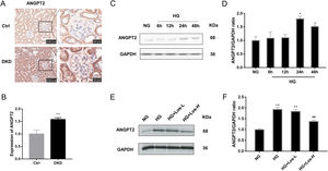 HG up-regulated ANGPT2 expression and losartan inhibited this process. (A) Representative immunohistochemical (IHC) staining of ANGPT2 in kidney. (B) Statistical data of IHC staining of ANGPT2 (n≥5). **P<0.01 vs. Control. (C) Representative western blot of ANGPT2; (D) Densitometric analysis of ANGPT2 western blot signals (n≥3). *P<0.05 vs. NG. (E) Western blot of ANGPT2 of hrGECs incubated with NG, HG, HG+Los-L, HG+ Los-H. (F) Densitometric analysis of western blot signals of ANGPT2 (n≥3). **P<0.01 vs. NG group, ##P<0.01 vs. HG group. Data are presented as means±SEM.