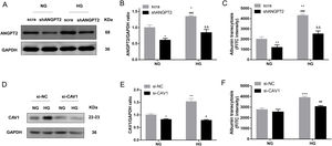 ANGPT2 and CAV1 downregulation inhibited albumin transcytosis in hrGECs. (A) Representative western blot of ANGPT2 with shANGPT2 for 72h. (B) Densitometric analysis of ANGPT2 western blot signals (n≥3). *P<0.05 vs. NG+scra (scramble shRNA), ###P<0.001 vs. NG+shANGPT2, &&P<0.01 vs. HG+ scra. (C) FITC-albumin uptake analysis. **P<0.01 vs NG+ scra, ###P<0.001 vs. NG+shANGPT2, &&P<0.01 vs. HG+ scra. (D) Representative western blot of CAV1 with si-CAV1 for 48h. (E) Densitometric analysis of CAV1 western blot signals (n≥3). *P<0.05 vs. NG+si-NC, **P<0.01 vs. NG+si-NC, #P<0.05 vs. HG+si-NC. (F) FITC-albumin uptake analysis. ***P<0.001 vs NG+ scra, ###P<0.001 vs. HG+si-NC. Data are presented as means±SEM.