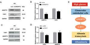 Regulation between ANGPT2 and CAV1 in hrGECs. (A) Western blot of ANGPT2 and CAV1 after transfection with shANGPT2 in HG condition. (B) Densitometric analysis of western blot signals of ANGPT2 and CAV1 (n≥3). **P<0.01 vs. scra. (C) Western blot of ANGPT2 and CAV1 after transfection with si-CAV1 in HG condition. (D) Densitometric analysis of western blot signals of ANGPT2 and CAV1 (n≥3). *P<0.05 vs. si-NC. (E) Summary chart of relationship between ANGPT2 and CAV1 in GECs during HG exposure. Data are presented as means±SEM.