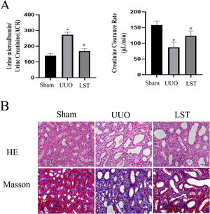 Losartan can alleviate renal pathological damage in UUO rats. (A) Endogenous creatinine clearance (Ccr) rate and urine microalbumin to urinary creatinine ratio (ACR). (B) HE was used to examine morphological changes and inflammatory cell infiltration. Masson was used to examine collagen deposition. The data are presented as the mean±SD, *P<0.05 vs. the Sham group, #P<0.05 vs. the UUO group. UUO: unilateral ureteral obstruction; LST: losartan.