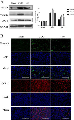 Losartan can ameliorate renal fibrosis in UUO rats. (A) Western blotting analysis using antibodies α-SMA, Vimentin and COL-1 against to examine renal fibrosis. (B) Immunofluorescence staining using antibodies against Vimentin and COL-1 to examine renal fibrosis. The data are presented as the mean±SD, *P<0.05 vs. the Sham group, #P<0.05 vs. the UUO group.