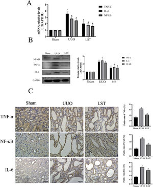 Losartan inhibits TNF signal pathway expression in UUO rats. (A) PCR measured the mRNA expression of TNF-α, IL-6 and NF-κB. (B) Western blotting analysis using antibodies TNF-α, IL-6 and NF-κB against to examine inflammation. (C) Immunohistochemical analysis using antibodies TNF-α, IL-6 and NF-κB against to examine inflammation. The data are presented as the mean±SD, *P<0.05 vs. the Sham group, #P<0.05 vs. the UUO group.