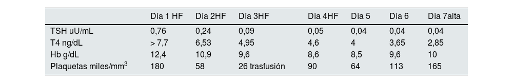 Tablas