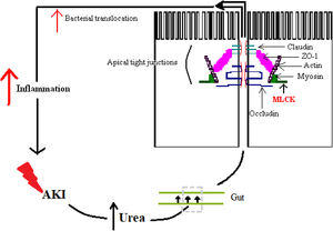 Colo-renal axis. AKI: acute kidney injury; ZO-1: zonula occludens 1; MLCK: myosin light chain kinase.