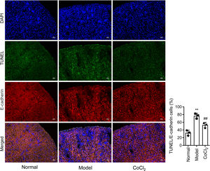 Co-staining using E-cadherin and TUNEL to detect apoptosis in renal tubular cells. Fluorescence intensity analyzed to assess renal tubule cell apoptosis; * indicates model vs. normal; # indicates CoCl2vs. model; n=6; **,## p<0.01.