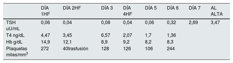 Tablas