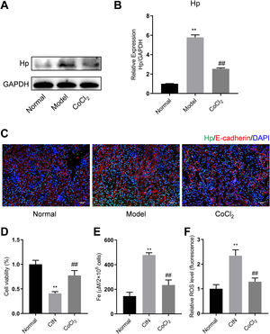 Western blotting, qPCR, and IF analyses of Hp from mouse kidney tissues. (A) Proteins tested thrice and normalized to GAPDH levels for quantitative analysis. (B) Quantitative analysis of Hp mRNA expression. IF co-stained four proteins and E-cadherin in renal tubular epithelial cells (C, magnification, 200×). (D–F) Cell viability, iron concentration, and ROS content estimated for ferroptosis levels. Each value represents mean±SD; * indicates model vs. normal; # indicates CoCl2vs. model; n=6; *,# p<0.05; **,## p<0.01.