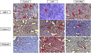 Immunoreactivities of AQP-1, Cas-3, NF-κB on kidney tissues. Groups: Control (AQP-1, Caspase-3 and NFkB p65), LPS (AQP-1, Caspase-3 and NFkB p65) and LPS+IRN (AQP-1, Caspase-3 and NFkB p65). LPS (AQP-1, Caspase-3 and NFkB p65), LPS (AQP-1, Caspase-3 and NFkB p65) and LPS+IRN (AQP-1, Caspase-3 and NFkB p65). AQP-1, CAS-3 and NF-kB p65 immunoreactivity in the proximal tubule (PT), glomeruli (G) and distal tubule (DT) in the medulla and cortex in control, LPS and LPS+IRN groups. Regions of immunoreactivity are indicated by red arrows. (DABx20, scale bar=100μm). The differences between the groups are shown in the score table (Table 2).