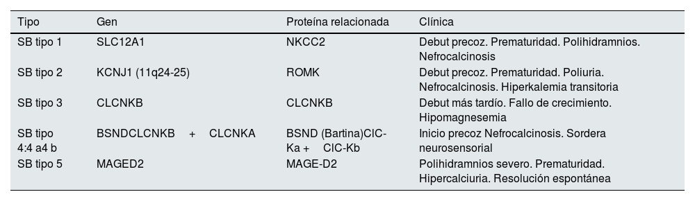 Tablas