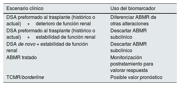 Tablas