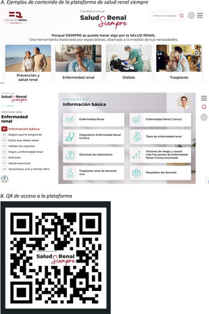 A)Ejemplos de contenido de la plataforma Salud Renal Siempre. B)QR de acceso a la plataforma.