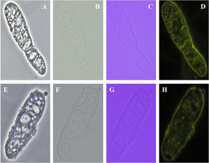 Cilindros vacuolados observados al microscopio con aumento ×400 mediante diferentes técnicas: contraste de fases (A y E), campo brillante (B y F), luz polarizada (C y G) y campo oscuro (D y H).