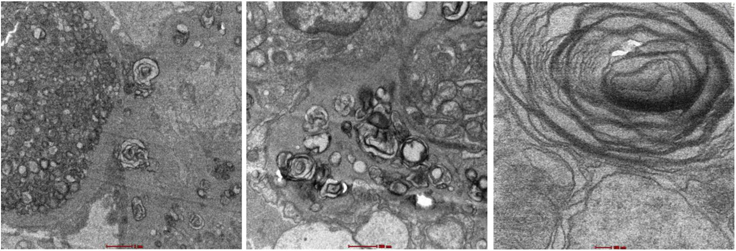 fig0005