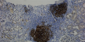 Immunohistochemical staining for cyclin D1.