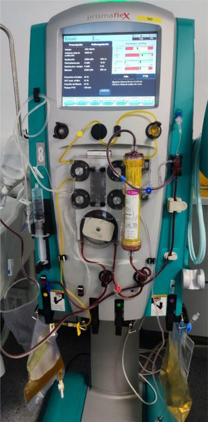 Monitor Prismaflex utilizado para las sesiones de plasmaféresis. Nótese el tono amarillento del filtro en contexto de la hiperbilirrubinemia severa.