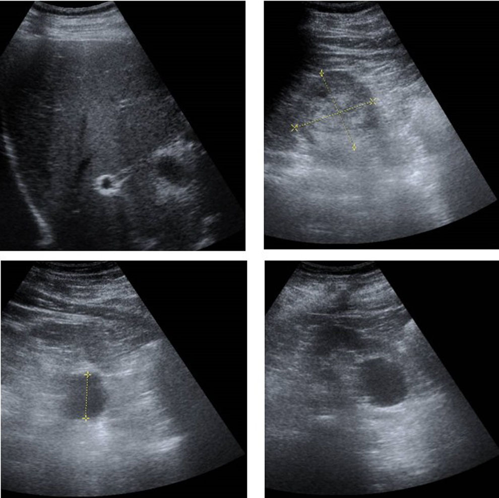 fig0010