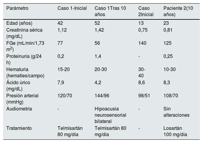 Tables