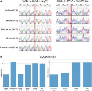 Sanger sequencing demonstrating (A, upper left) the presence of the variant SLC8A1 c.16C>T p.(Arg6*) in the affected brothers (IV:1 and IV:2) and its absence in the affected paternal aunt (III:5), the healthy uncle (III:4) an the mother (III:1); and (A, upper right) the presence of the variant PKD1 c.9170T>C p.(Val3057Ala) in the two affected brothers (IV:1 and IV:2) and their healthy mother (III:1). (B) Quantitative polymerase chain reaction (qPCR) results confirmed the heterozygous UMOD deletion involving exon 11 in all affected family members (IV:1, IV:2, III:5) and its absence in the unaffected ones (III:4, III:1).