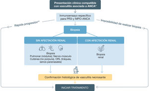 Estrategia diagnóstica en las vasculitis asociadas a anticuerpos anticitoplasma de neutrófilo (ANCA). El diagnóstico se debe sustentar en tres aspectos: manifestaciones clínicas, serología e histología. *Ver Tabla 2.Características clínicas de la GPA y PAM. **Si rápida progresión y ANCA positivos, no es necesario esperar los resultados de la biopsia para iniciar tratamiento. ANCA: anticuerpos anticitoplasma de neutrófilo; PR3: proteinasa 3; MPO: mieloperoxidasa; ORL: otorrinolaringológico.