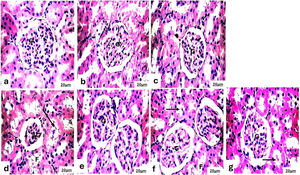 Photomicrograph of the kidneys of (a) the control rats, (b) the SBCL-NEG group treated with a dose of 10mg/kg of compound A, and (c) the SBF-NEG group treated with a dose of 10mg/kg of compound B exhibited a normal structure of the renal corpuscle, proximal tubules, and distal tubules. The renal corpuscle consisted of a glomerulus (G), mesangium, and Bowman