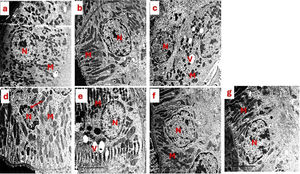 Photomicrograph of the ultrastructure of the kidney tubules of (a) control group showed normal renal tubules with normal nucleus (N) surrounded by spherical and elongated mitochondria (M). (b) The SBCL-NEG group, which received a dosage of 10mg/kg of compound A, and (c) the SBF-NEG group, which received a dosage of 10mg/kg of compound B exhibited no observable harm based on the preservation of the basal lamina of renal tubules in the kidney tissue of rats. The nucleus (N) displayed a typical morphology and was surrounded by numerous mitochondria (M), which varied in shape from spherical to elongated. These mitochondria exhibited abundant cristae, and the endoplasmic reticulum cisternae appeared smoothly. A few vacuoles (V) emerged within the cytoplasm. (d) The experimental positive control group (EG) that was administered 5% of EG showed clear ultrastructural abnormalities, including necrotic nucleus (N) (arrow), degraded mitochondria (M), and loss of cristae in certain mitochondria, accompanied by an increase in cytoplasmic vacuoles. (e) The IND-EG group showed a normal nucleus (N), but their mitochondria have deteriorated. Some of the mitochondria have lost their cristae, and there is an increase in vacuoles in the cytoplasm (V). (f and g) The SBCL-EG and SBF-EG groups showed a typical nucleus (N) surrounded by a plentiful number of mitochondria (M), which varied in shape between spherical and elongated. These mitochondria were particularly rich in cristae.