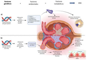 Creado en BioRender.com. Mecanismos de acción de los genes ELMO1 y AGTR en la génesis de la ERD. a) Mecanismo de los polimorfismos del gen ELMO1. Los polimorfismos de ELMO1 alteran la expresión del gen ELMO1 y favorecen el desarrollo de fibrosis intersticial, atrofia tubular y glomeruloesclerosis difusa a través del incremento en la expresión de genes profibróticos e inhibición de genes antifibróticos. b) Mecanismo del polimorfismo rs5186 del gen AGTR1. El polimorfismo favorece la inestabilidad en la transcripción del gen AGTR1 favoreciendo la expresión alterada del receptor AT1, que ocasiona una activación persistente del SRAA, caracterizada por un aumento de la presión intraglomerular y la lesión y pérdida de podocitos, dañando la arquitectura de la MBG favoreciendo la proteinuria.MBG: membrana basal glomerular; SRAA: sistema renina angiotensina aldosterona; TGFβ-1: factor de crecimiento transformante beta 1.