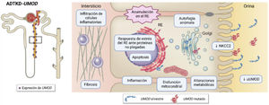 Esquema sobre la patofisiología de alteraciones en UMOD. A la izquierda, se representa la restringida expresión de UMOD a la rama ascendente de Henle y las primeras secciones del túbulo contorneado distal. A la derecha, los procesos alterados debido a la expresión de UMOD mutante. Fuente: adaptado de Mabillard, H. et al. (2023)7. NKCC2: cotransportador sodio-potasio-cloro (Na+-K+-2Cl−); RE: retículo endoplasmático; uUMOD: UMOD en orina.